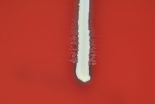 látható (nyíl), B: szatellitizmus. A haemet tartalmazó véres táptalajon a NAD-ot a Staphylococcus aureus biztosítja. Annak növekedése mellett az apró haemophilus telepek is kitenyésznek 3.3.35. b. ábra.