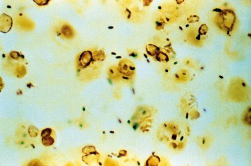 hatása lenne. Kétségtelen azonban, hogy néhány járvány esetén utólag, szerológiai módszerekkel igazolható volt a betegeknél a legionella expozíció.