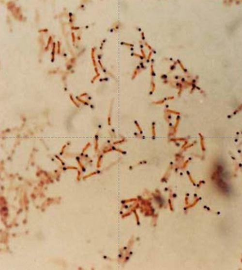 3.3.45. ábra. Corynebacterium diphtheriae.