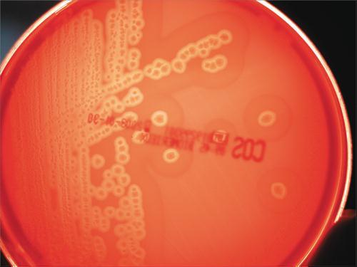 3.3.56. a. ábra. Clostridium perfringens. A: C. perfringens tenyészet véres agar táptalajon.