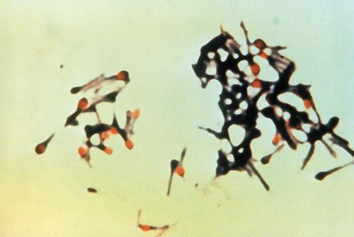 A nekrotizáló enteritis( pig-bel ) az új-guineai bennszülötteknél megfigyelt kórkép, Sporadikus esetek más országokban is előfordulhatnak, elsősorban olyanok között, akiknél a tripszintermelést