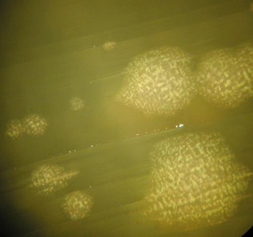 3.3.60. b. ábra. Patogenezis A C. difficile által okozott kórképek tüneteiért exotoxinjai a felelősek.
