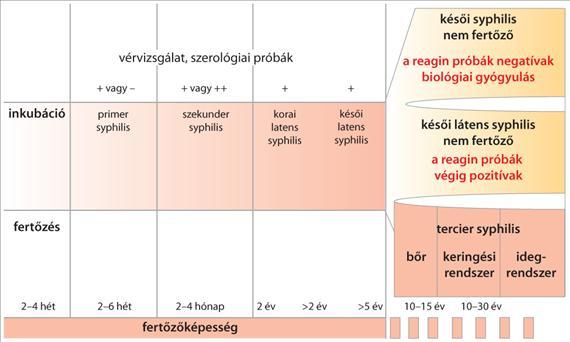 3.3.69. ábra A syphilis klinikai lefolyásának szakaszai és a T.
