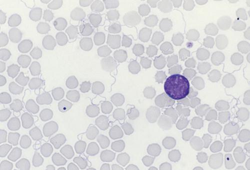 3.3.71. ábra Borreliák vérkenetben. Giemsa-festés (www.sciencephoto.com M200/179) 3.11.2.2. Patogenezis A kórokozó fertőzött ízeltlábúak csípése után a vérrel jut el a különböző szervekhez.