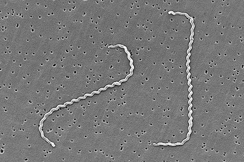 A Leptospira genusba két faj tartozik: a L.interrogans és a L.biflexa. Mindkét species sok szerológiai változatot tartalmaz. A L.