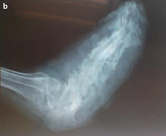 (Haitham Alfalah felvétele, King Saud Medical