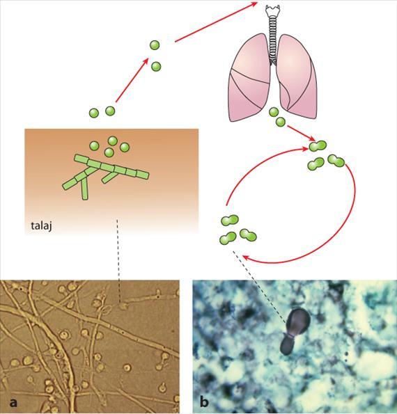 4.4.1. Blastomycosis Az USA közép-nyugati, Kanada és Afrika egyes, általában hűvös, nedvesebb területein endémiás, feltehetően a talajban, rothadó növényeken élő gomba a Blastomyces dermatitidis.