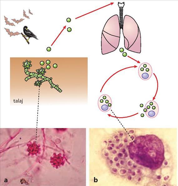 3.4.23. ábra. A histoplasmosis patogenezise. A: a Histoplasma capsulatum jellegzetes dudoros microconidiumai (Public Health Image Library, CDC, Atlanta, USA. No. 4023. Dr.