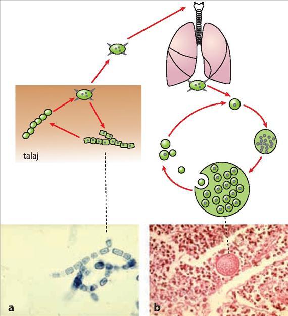 3.4.25. ábra. A coccidioidomycosis patogenezise. A: Coccidioides immitis arthroconidiumai (Public Health Image Library, CDC, Atlanta, USA. No. 476. Dr. Hardin felvétele), B: C.