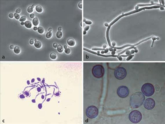 3.4.27. ábra. Candidasejtek mikroszkópos morfológiája. A: sarjadzó sejtek, B: blastoconidiumok és pseudohyphak, C: csíratömlők (Public Health Image Library, CDC, 1214, Dr. Lucille K.