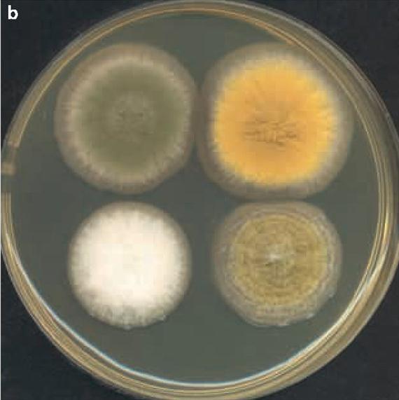 3.4.29. b. ábra. 4.5.2.2. A legfontosabb klinikai megjelenési formák Az exogén forrásbólbelélegzés útján a aspergillus condiumok főként az orr-melléküregekbe, a felső és alsó légúti traktusba jutnak.