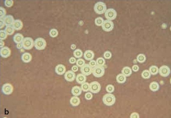 (Public Health Image Library, CDC, No. 3771, Dr.