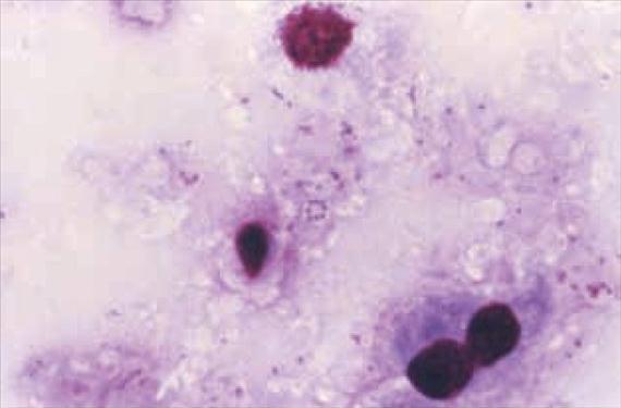 A Pneumocystis jirovecii (korábbi nevén P. carinii) rendszertani besorolása nem mentes a bizonytalanságoktól. Sokáig protozoonnak tartották, ma egyértelműen a gombák közé sorolják.