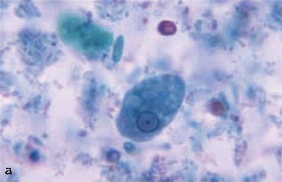 A protozoonok által okozott betegségek tárgyalásakor a hagyományoknak és gyakorlati meggondolásoknak megfelelően a klinikai és rendszertani csoportosítás keverékét használjuk.