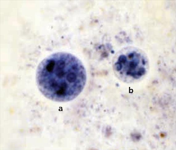 3.5.4. ábra. Entamoeba coli és E. histolytica cysták. A: Entamoeba coli cysta, B: Entamoeba histolytica cysta (Public Health Image Library, CDC, 442.