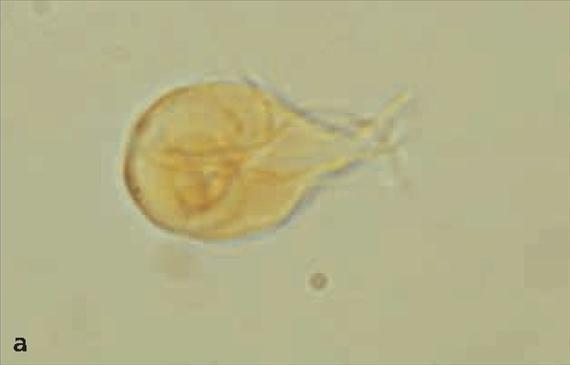 3.5.5. a. ábra. Giardia lamblia székletben. A: Trophozoita, B: Cysta. Jódfestés(Public Health Image Library, CDC, 3904. Dr.