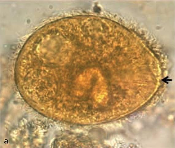 A protozoonok közül a legnagyobb, 40 100 µm átmérőjű trophozoita felszíne csillókkal borított, testének elülső végén kezdetleges tölcsérszerű szájnyílás, a cytostoma látható (3.5.8. ábra, A).