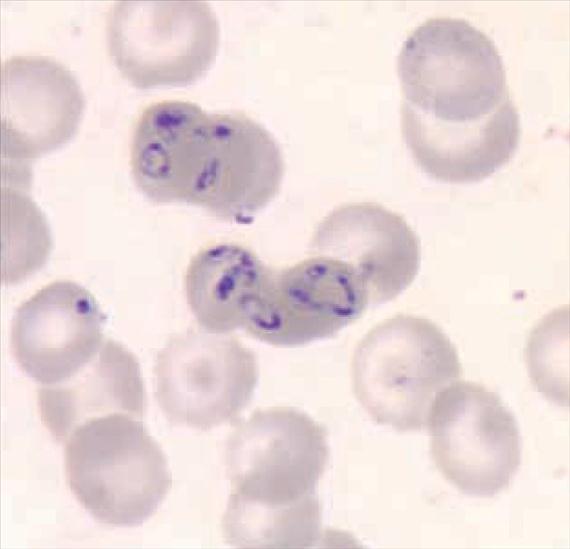 3.5.21. ábra. Babesiosis. Intracelluláris Babesia sp. vérkenetben (Giemsa-festés). CDC, Division of Parasitic Diseases, Parasite Image Library () A diagnózis alapja a vérkenet vizsgálata.