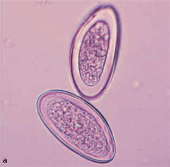 3.5.24. a. ábra. Az Enterobius vermicularis morfológiája.