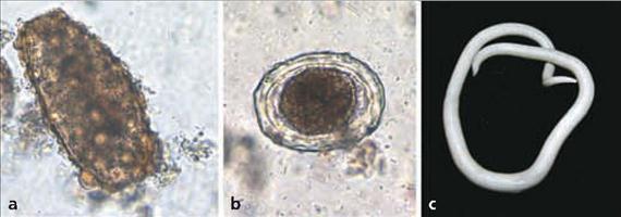 3.5.28. ábra. Az Ascaris lumbricoides morfológiája.