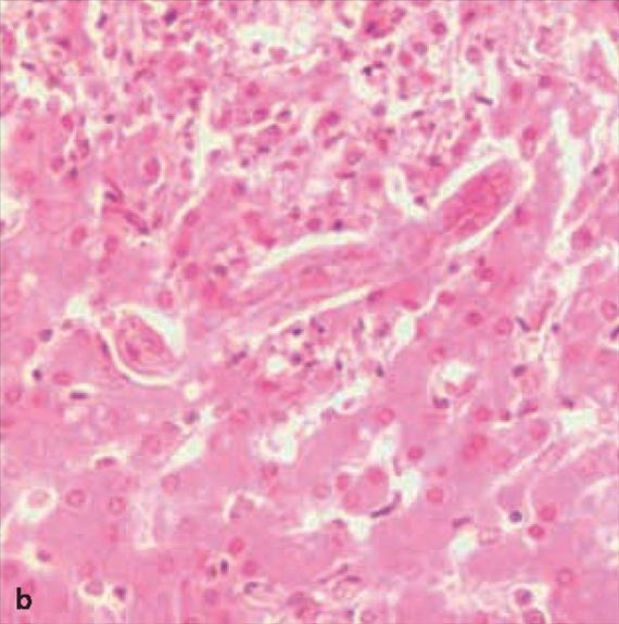 3.5.30. a. ábra. A Toxocara fajok morfológiája. A: Toxocara faj petéje (A New Jersey State Public Health Laboratory anyagából), B: Toxocara faj lárvája májban (Haematoxylin-Eozin festés).