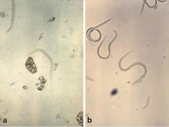 3.5.32. ábra. A Strongyloides stercoralis morfológiája.