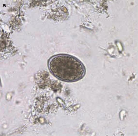 3.5.38. a. ábra. A Diphyllobotrium latum morfológiája.