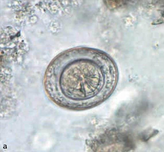 3.5.40. a. ábra. A Hymenolepis nana morfológiája. A: peték festetlen készítményben. Megfigyelhetőek a horgok és filamentumok, B: kifejlett férgek, C: Scolex festetlenül, nagy nagyítással.