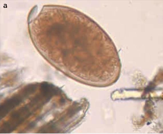 buski Schistosoma fajok S. mansoni vízicsiga ember schistosomiasis, bilharziasis S. japonicum S.