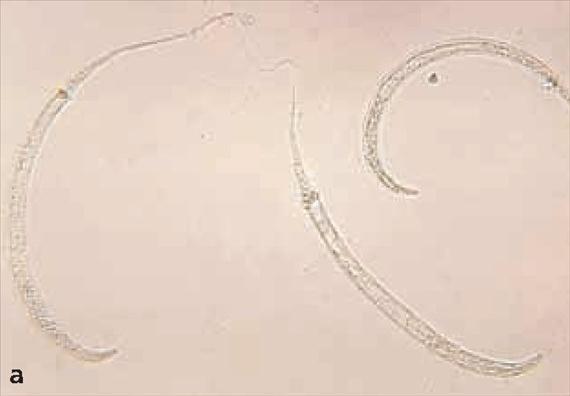 3.5.59. a. ábra. Dracunculus medinensis.