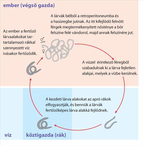 Az emberek az apró, lárvákat hordozó Cyclops-fajhoz tartozó rákokkal fertőzött víz ivásakor fertőződnek.