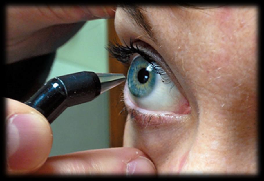 RIZIKÓFAKTOROK CENTRÁLIS CORNEA VASTAGSÁG CCT Átlagos cornea vastagság: 540 µm Minden egyes 40 µm el csökkenő cornea