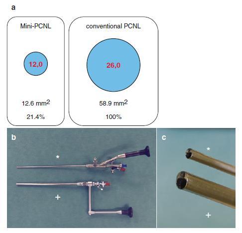 Mini-PCNL