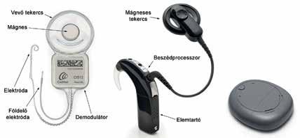 24. ábra: CI Nucleus és Kanso beszédprocesszorral (Cochlear, Ausztrália, Sidney) 25.
