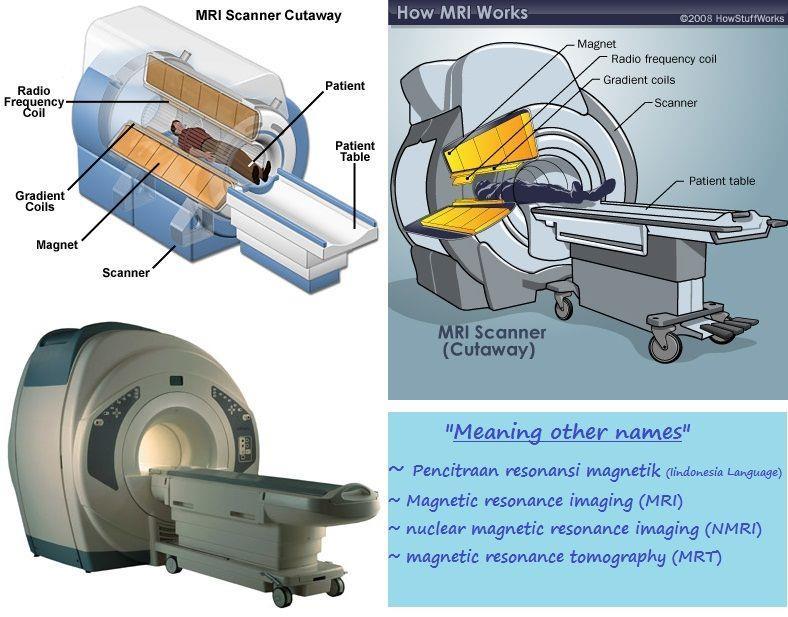 MRI