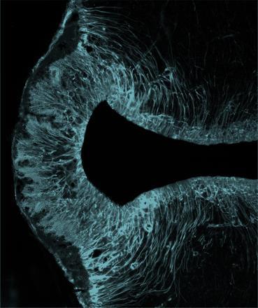 A hypothalamo-hypophysealis rendszer és a hypophysis Dr.