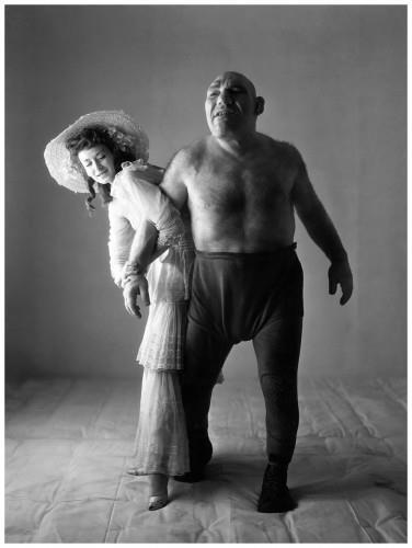 Gigantism Acromegaly