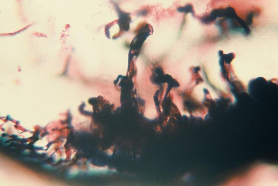 A hypothalamo-hypophysealis és a tuberoinfundibularis pályák az eminentia mediana külön zónáiban haladnak parvocellularis neuron ependima tractus