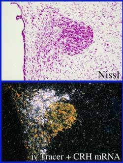 A nucleus paraventricularis hypothalaminak (PVN) magno- és parvocellularis