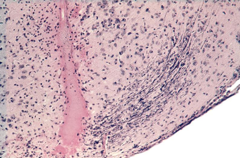 Palkovits M: Isolated removal of hypothalamic or other brain