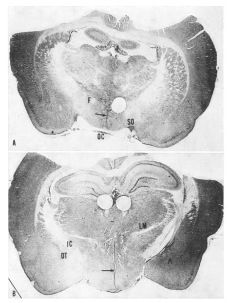 Brain Res 59:449-450 (1973) Paraventricularis mag Tractus