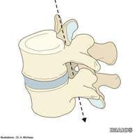 Foramen