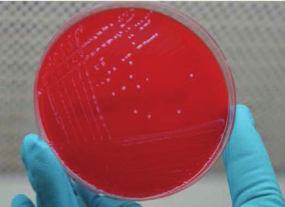 Streptococcus uberis kimutatása qpcr-rel szárított tejmintából és bakteriológiai tenyésztéssel folyékony tejmintából Bevezetés A Streptococcus uberis (Strep.