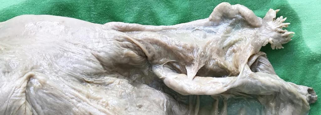 ampulla