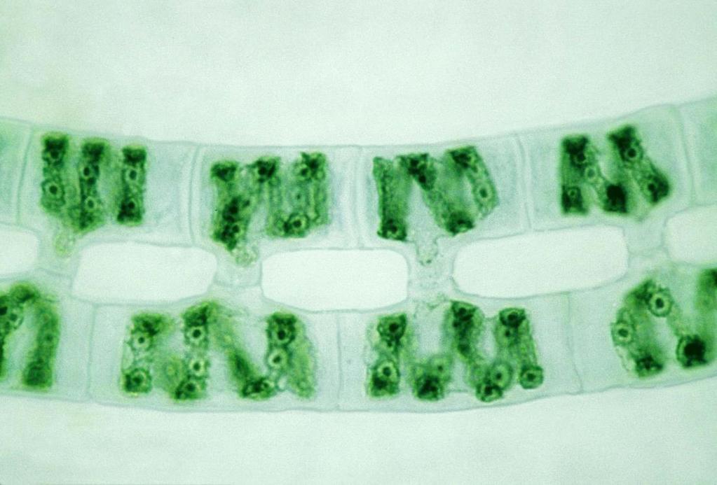 békanyálmoszat (Spirogyra) -