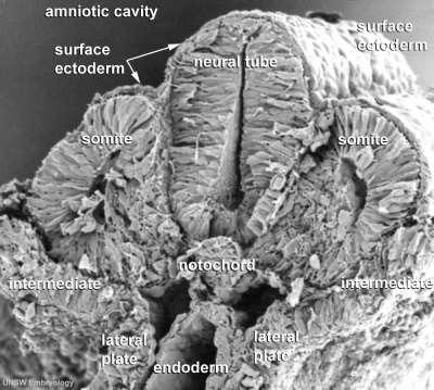 Week 4Scanning electron micrograph of a cross-section of a human embryo at week 4
