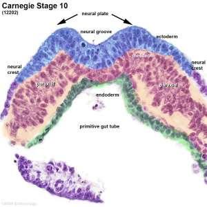Note the mesoderm structures now present and their relative position and size within