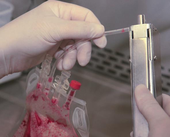 A gyűjtött köldökzsinórvér minták 50 ml felett, és/vagy a magvas őssejtszám protokoll szerinti minimum értéke felett kerülnek feldolgozásra. Tapasztalataink szerint a minták kb.