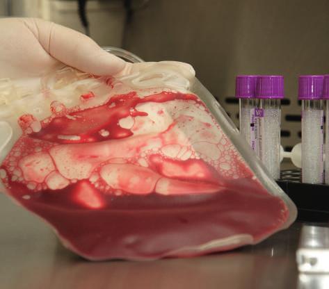 transzplantációt megelőző vizsgálatok (életképesség, sterilitás, allogén transzplantáció esetén szöveti