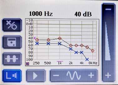 2. ábra: Audiogram (saját fotó készült: 2019. 08. 14-én) Az audiogramon a függőleges értékek a hangerőt (db), a vízszintes értékek pedig a hangmagasságot (Hz) jelenítik meg.